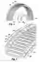 Fig. 05 - Electrical machine with double-sided lamination stack