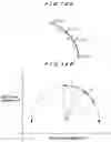 Fig. 11 - Eddy current sensor