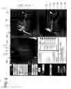 Fig. 03 - Method for localized excitation for accurate center frequency measurements with MRI