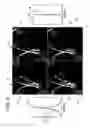 Fig. 06 - Method for localized excitation for accurate center frequency measurements with MRI