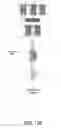Fig. 17 - Threshold search failure analysis