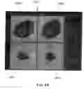Fig. 21 - System and method for performing a three-dimensional virtual examination of objects, such as internal organs