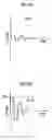 Fig. 10 - Liquid ejection apparatus and ejection abnormality factor extraction method