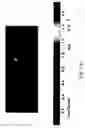 Fig. 09 - Blind devices and methods for providing continuous thermophoretic protection of lithographic reticle