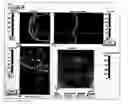 Fig. 01 - Method of bioimage data processing for revealing more meaningful anatomic features of diseased tissues