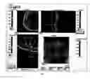 Fig. 02 - Method of bioimage data processing for revealing more meaningful anatomic features of diseased tissues