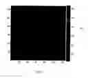 Fig. 03 - Method of bioimage data processing for revealing more meaningful anatomic features of diseased tissues