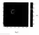 Fig. 07 - Method of bioimage data processing for revealing more meaningful anatomic features of diseased tissues