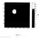 Fig. 11 - Method of bioimage data processing for revealing more meaningful anatomic features of diseased tissues