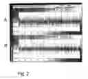Fig. 03 - APPARATUS FOR MEASURING THE POSITION OF AN OBJECT WITH A LASER INTERFEROMETER SYSTEM