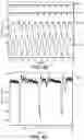 Fig. 13 - Integrated displacement sensors for probe microscopy and force spectroscopy
