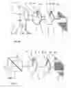 Fig. 05 - Method and device for attenuating light as a function of intensity