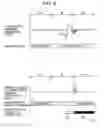 Fig. 09 - Reproduction device and method, recording medium, and program