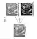 Fig. 11 - Method and apparatus for enhancing contrast