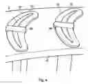 Fig. 05 - Vane support in a gas turbine engine