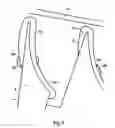 Fig. 06 - Vane support in a gas turbine engine