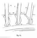 Fig. 09 - Vane support in a gas turbine engine