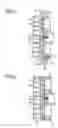 Fig. 04 - Scroll fluid machine having oil-supply holes being formed through a reinforcement bearing plate on a rear surface of the orbiting scroll