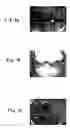 Fig. 08 - Microreactor including magnetic barrier