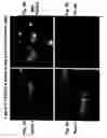 Fig. 07 - Ovr115 antibody compositions and methods of use
