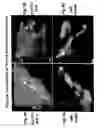 Fig. 08 - Ovr115 antibody compositions and methods of use