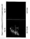 Fig. 09 - Ovr115 antibody compositions and methods of use