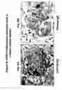 Fig. 10 - Ovr115 antibody compositions and methods of use