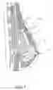 Fig. 03 - Breast augmentation system