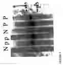 Fig. 04 - Use of compounds that bind soluble endoglin and SFLT-1 for the treatment of pregnancy related hypertensive disorders
