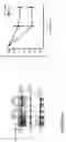 Fig. 41 - Use of compounds that bind soluble endoglin and SFLT-1 for the treatment of pregnancy related hypertensive disorders