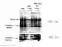Fig. 14 - Compositions, methods, and kits relating to resistin