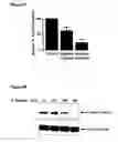 Fig. 05 - Composition and method for the treatment of cancer and other physiologic conditins based on modulation of the ppar-gamma pathway and her-kinase axis