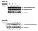 Fig. 07 - Composition and method for the treatment of cancer and other physiologic conditins based on modulation of the ppar-gamma pathway and her-kinase axis