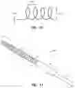 Fig. 06 - Aneurysm embolization material and device