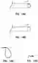 Fig. 08 - Aneurysm embolization material and device