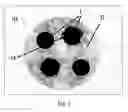 Fig. 03 - Multiphase active ingredient formulation