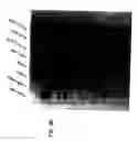 Fig. 15 - Compositions and methods for cancer treatment