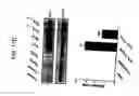 Fig. 20 - Compositions and methods for cancer treatment