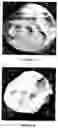 Fig. 22 - Degradable chewing gum