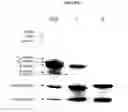 Fig. 04 - Purification of beta casein from milk