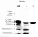 Fig. 05 - Purification of beta casein from milk