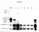 Fig. 06 - Purification of beta casein from milk