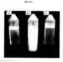 Fig. 07 - Purification of beta casein from milk