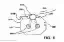 Fig. 04 - Doctor method
