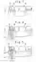 Fig. 02 - Prosthesis-fixing structure and prosthesis-fixing method