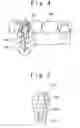 Fig. 03 - Prosthesis-fixing structure and prosthesis-fixing method
