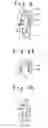 Fig. 05 - Prosthesis-fixing structure and prosthesis-fixing method
