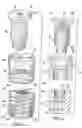 Fig. 03 - Combination distraction dental implant and method of use