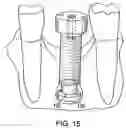 Fig. 11 - Combination distraction dental implant and method of use