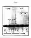 Fig. 02 - Uncoupling of DNA insert propagation and expression of protein for phage display